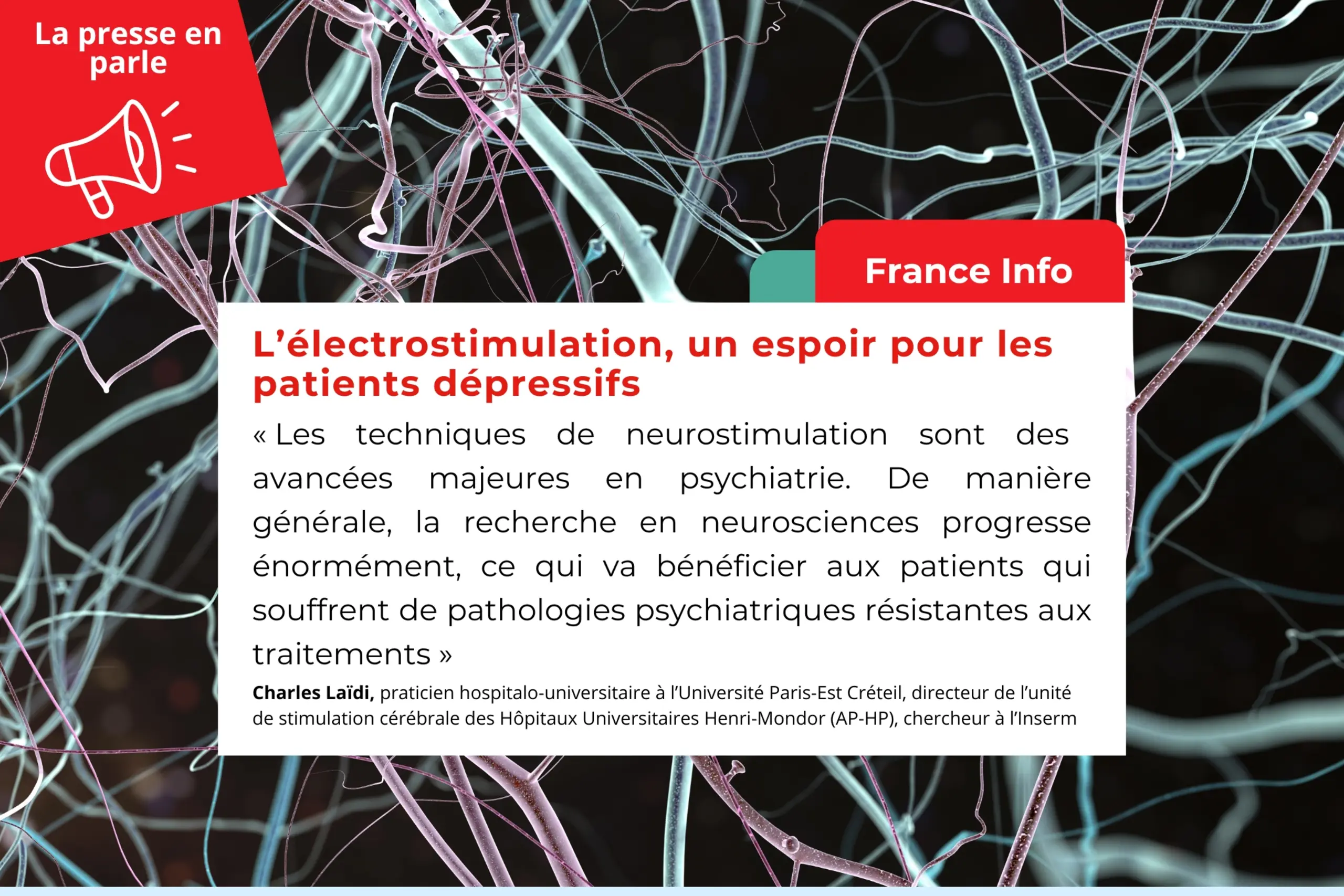  L’électrostimulation, un espoir pour les patients dépressifs