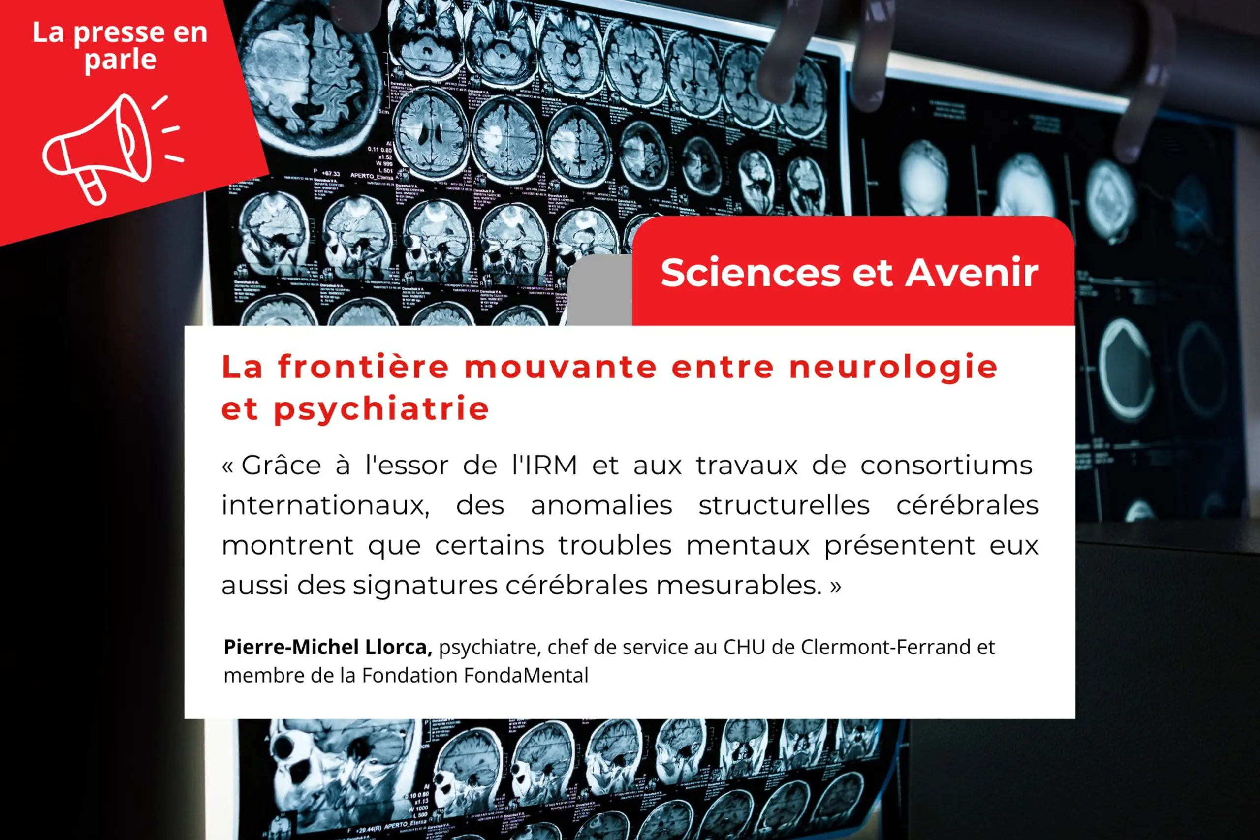 Sciences et Avenir | La frontière mouvante entre neurologie et psychiatrie Sciences et Avenir | La frontière mouvante entre neurologie et psychiatrie