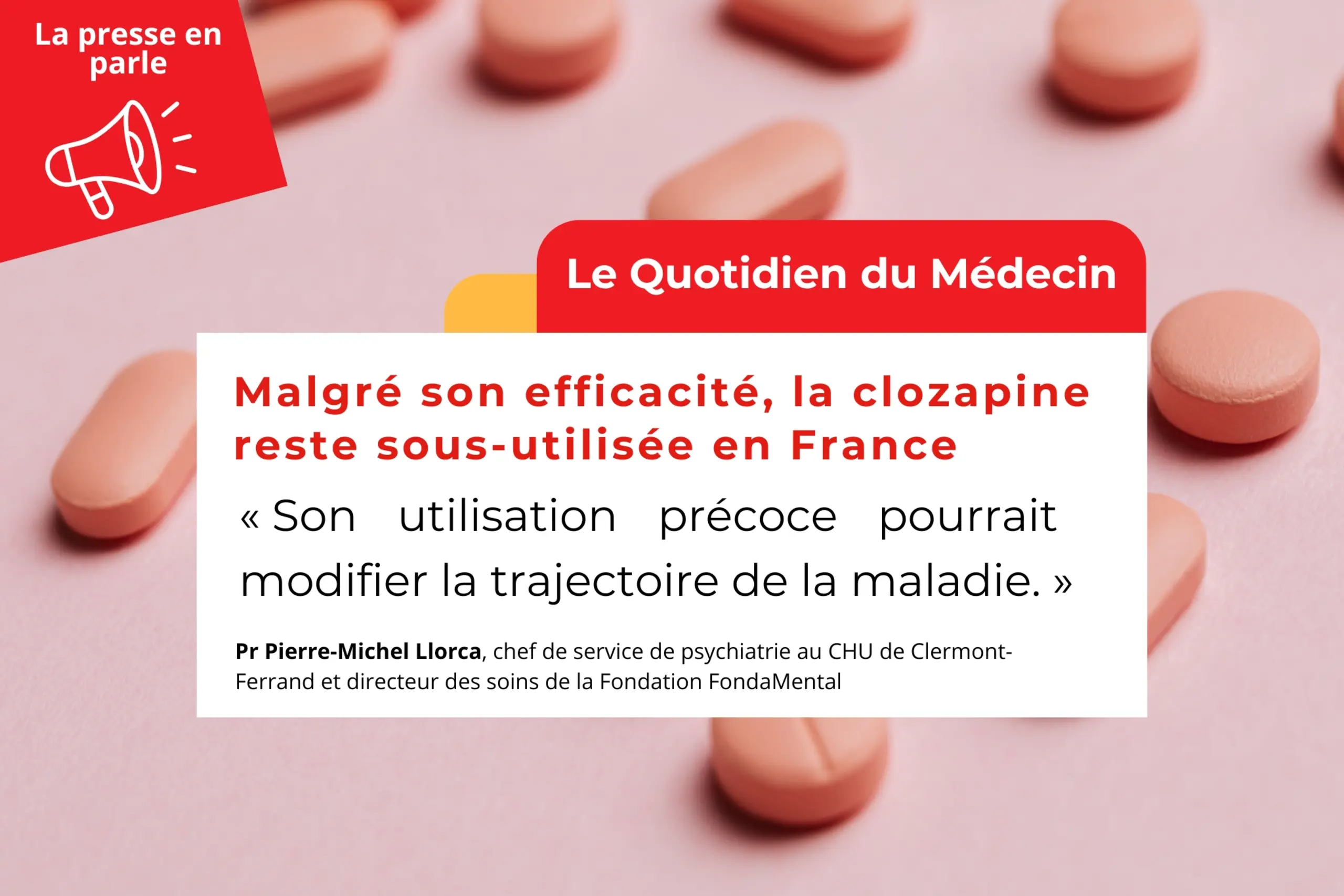 Le Quotidien du Médecin | Malgré son efficacité, la clozapine reste sous-utilisée en France